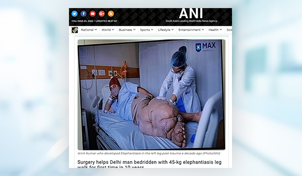 Max Healthcare, Plastic Surgeon in Vaishali, Plastic Surgeon in Noida, Best Plastic Surgeon in East Delh